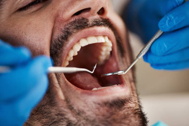 Dental X-Rays and Imaging in New Johnsonville, TN